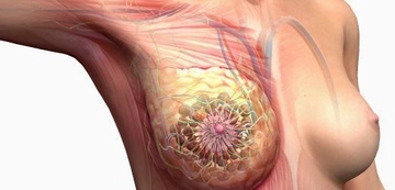 Sağ Memede Sancı Belirtileri ve Tedavisi Sağ Memede Sancı Belirtileri ve Tedavisi